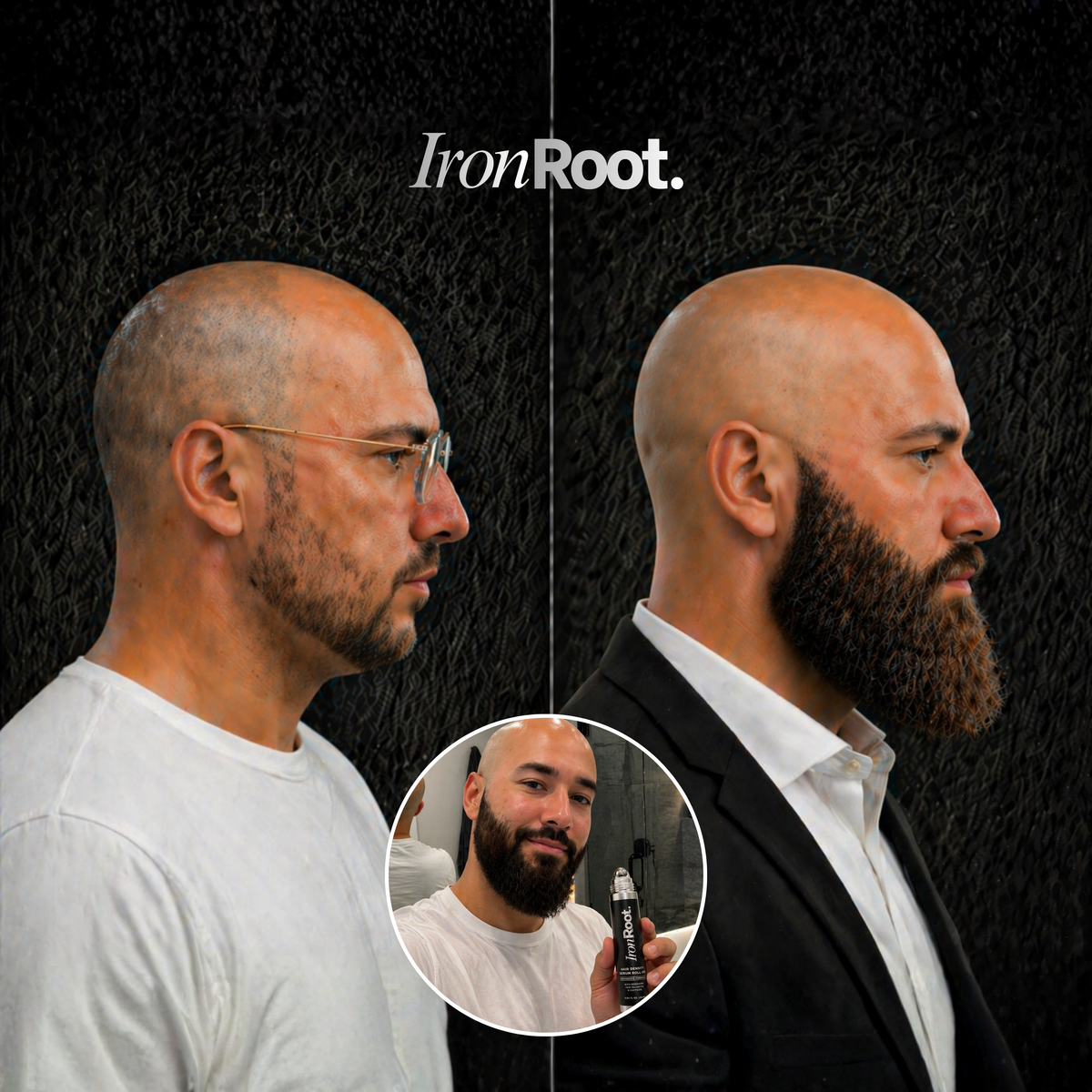 IronRoot Beard Activator
